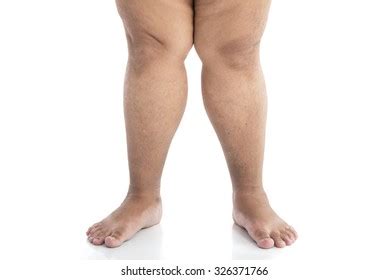 fat guy legs|840+ Fat Man Legs Stock Videos and Royalty.